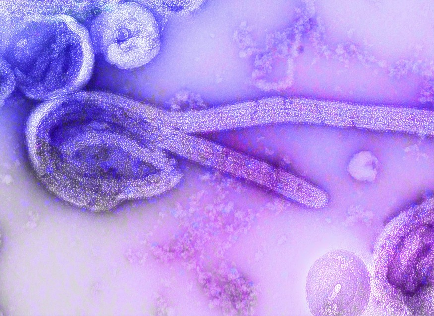 worm like view from a microscope
