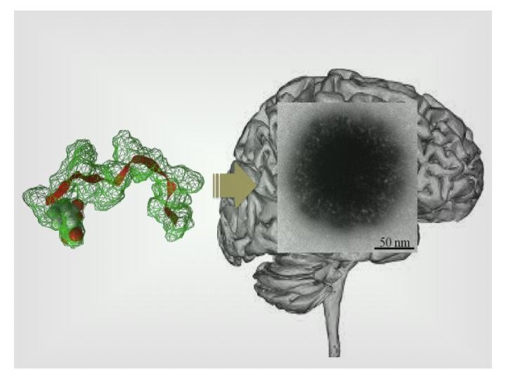 Targeting the Brain (IMAGE)