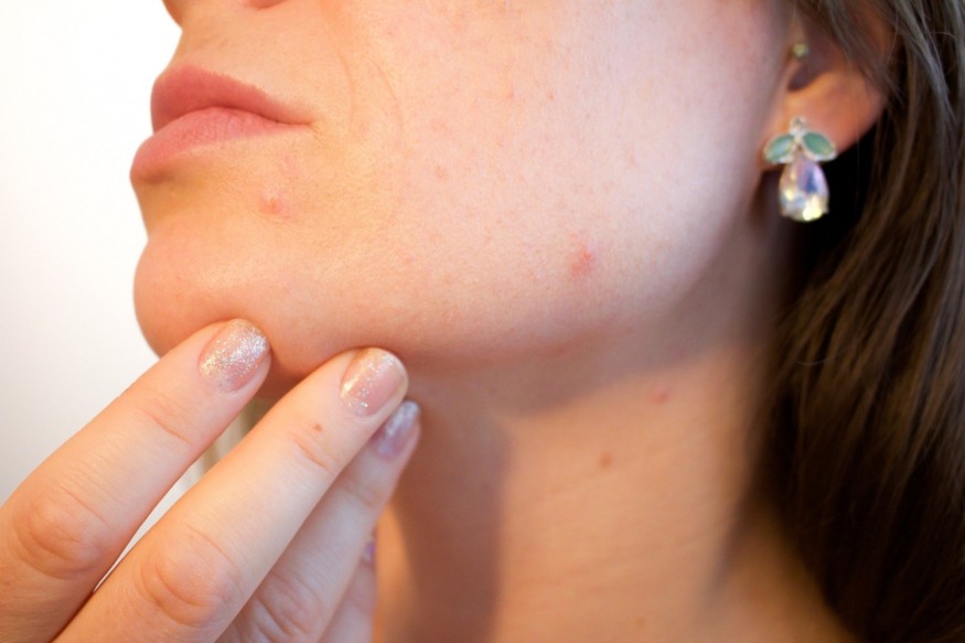 Of Breakouts and Anxiety - How Mental Health Affects Skin Conditions