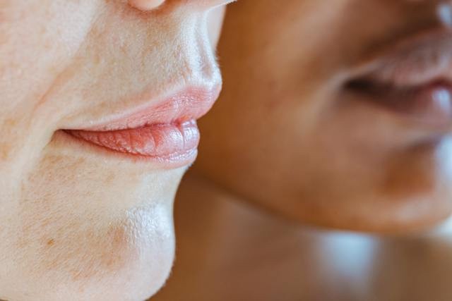 flawless skin