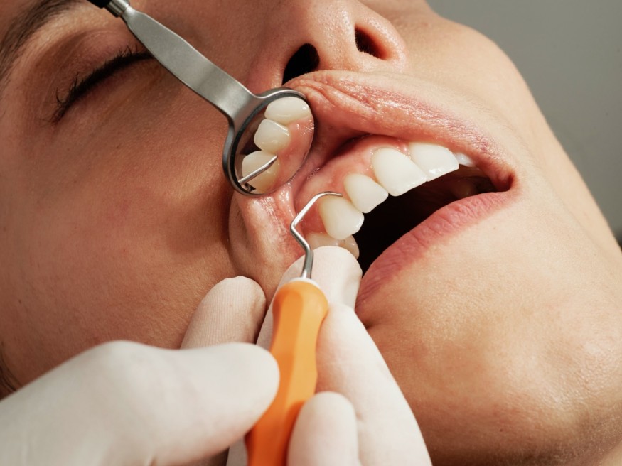 dental check up