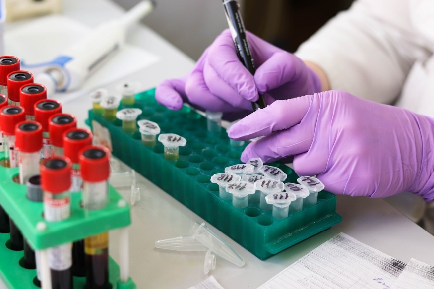 blood testing