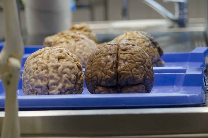 human brains