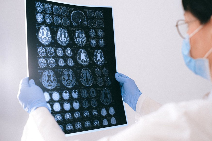 Key Differences Between Neurotypical and ADHD Brains